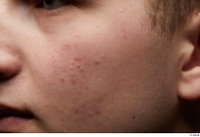  HD Face Skin Casey Schneider cheek face skin pores skin texture 0002.jpg